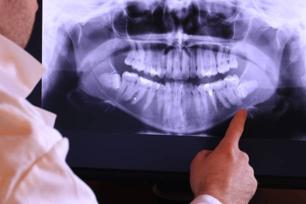 Best Walk-In Emergency Dentist in West Ocean City, MD